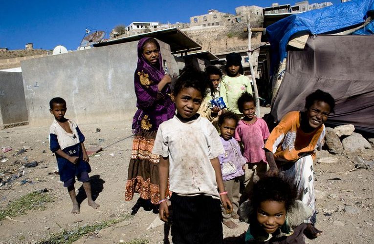 El mundo olvidó mirar a Yemen: El país a traviesa una hambruna generalizada y el consecuente incremento de niños en peligro de morir de hambre.